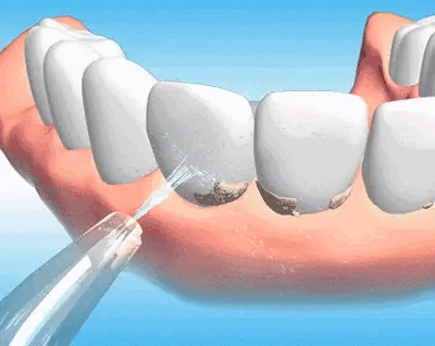 Komplet Za Savršen Osmijeh – Oralni Čistač + Pasta Za Izbjeljivanje GRATIS!