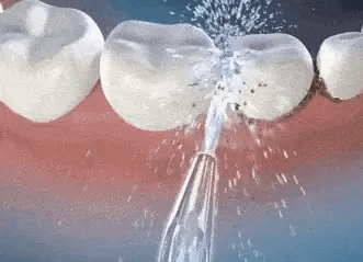 Komplet Za Savršen Osmijeh – Oralni Čistač + Pasta Za Izbjeljivanje GRATIS!